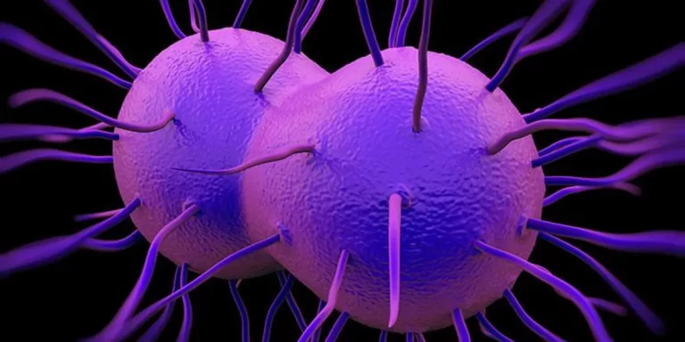 gonorrhea