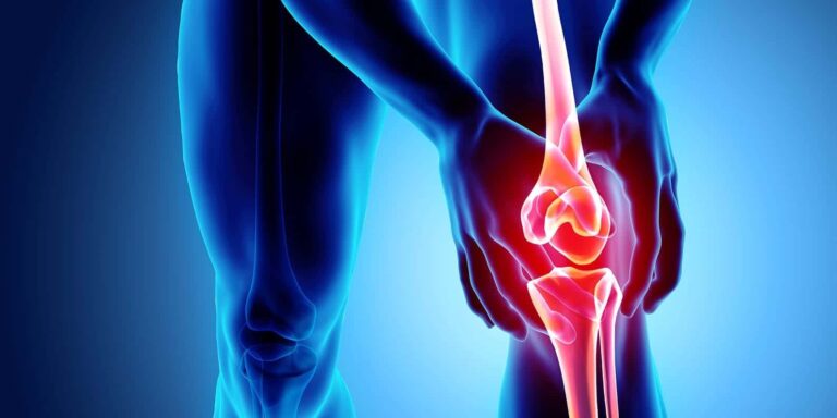 knee-osteoarthriti