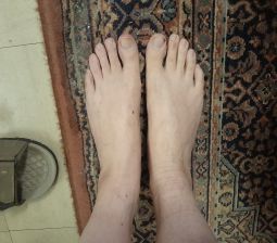 Rate my feet from 1 to 10 plz