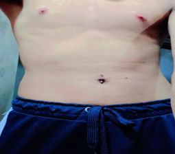 Femboy Belly Piercing 