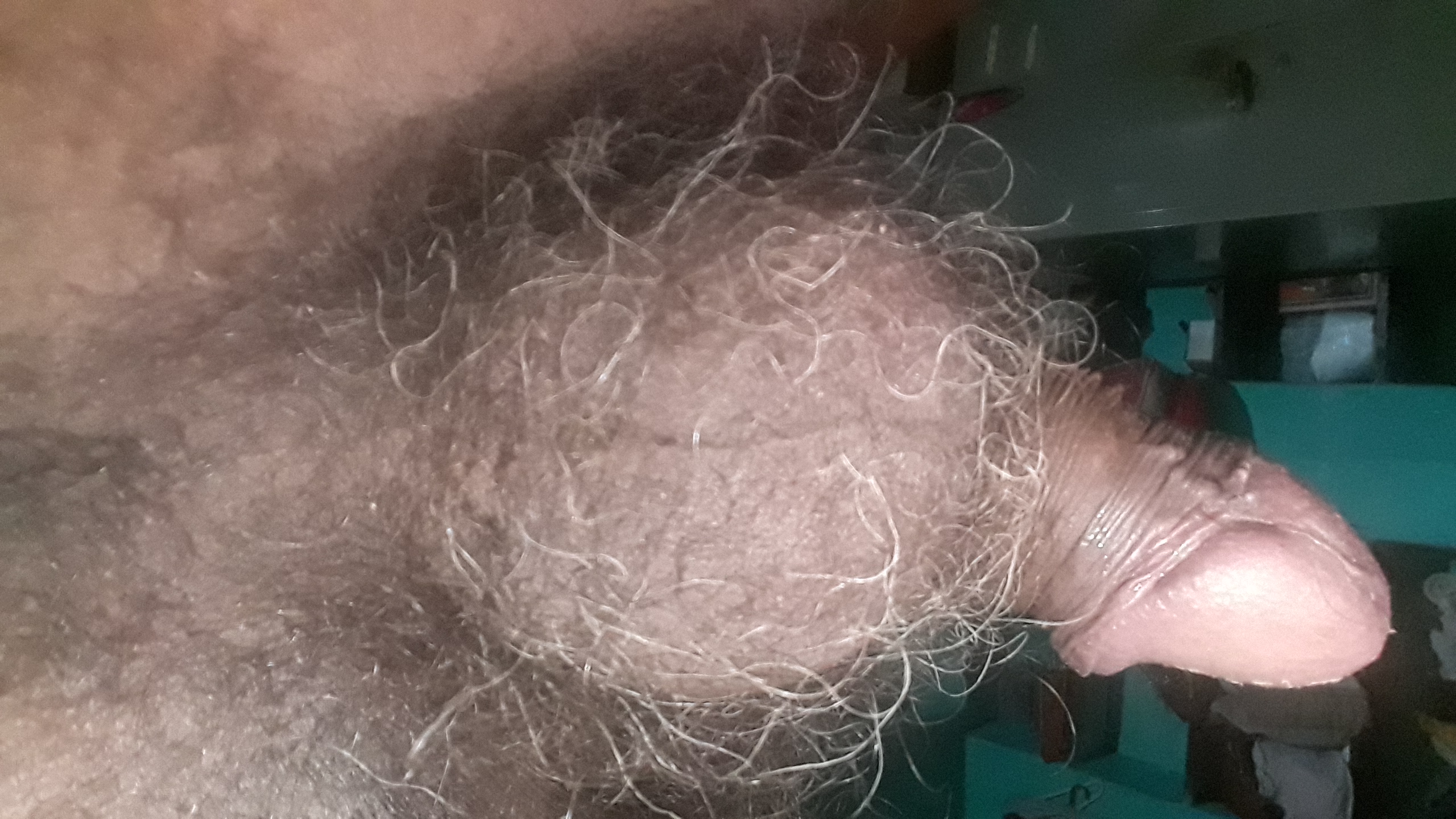 Hairy ball