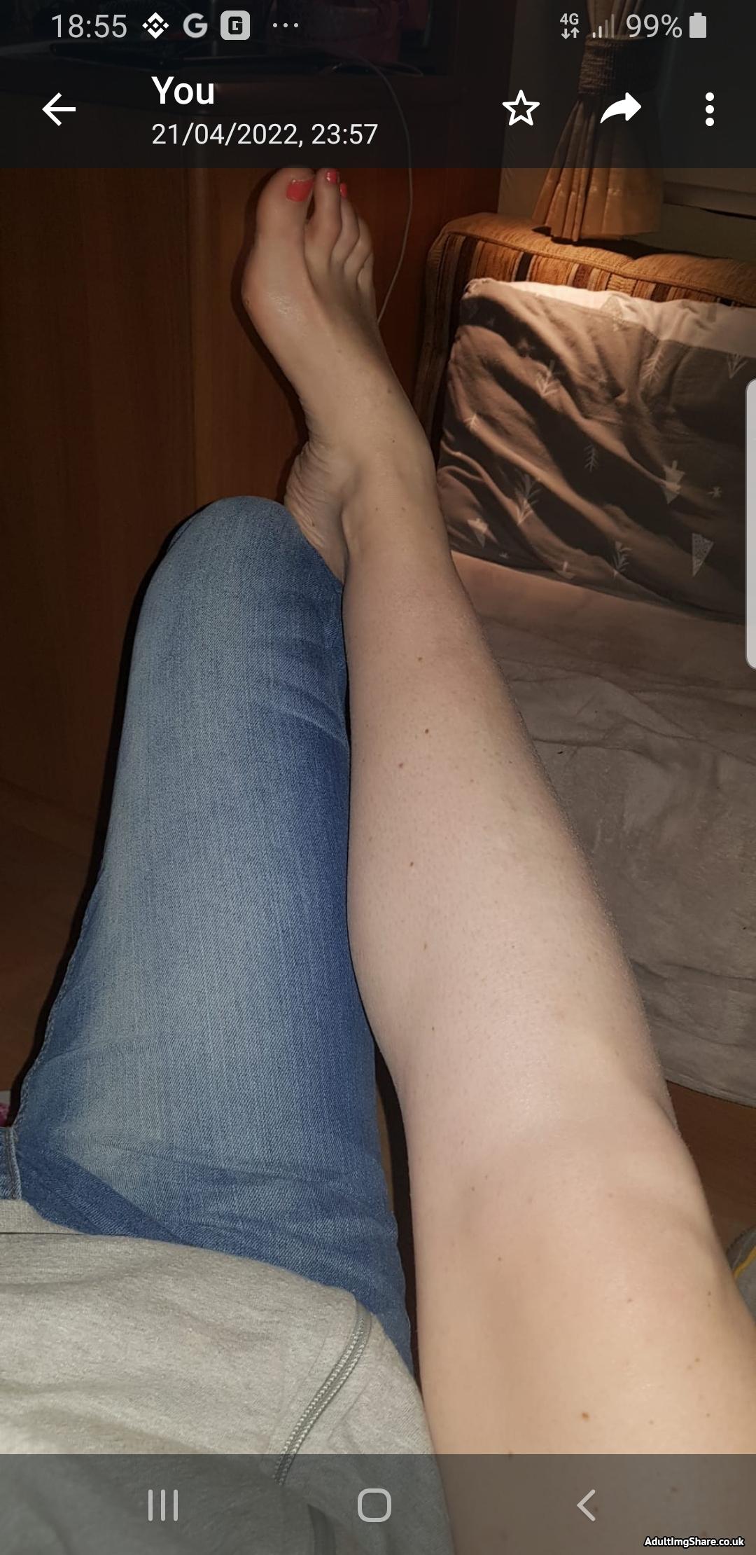 My pathetic skinny leg - AdultImgShare